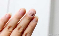 不锈钢指甲划痕修复视频教程