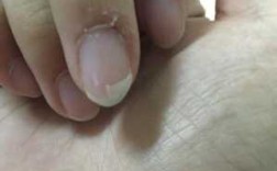  指甲被切成两半还会修复吗「指甲被切断了一半怎么办」