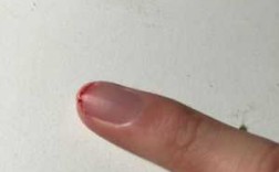 指甲受伤了身体怎么修复的_指甲受伤后怎么修复