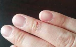  修复指甲边缘裂开了怎么办「修复断裂指甲」