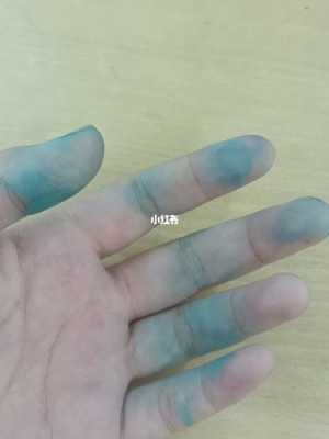  手被染料染色了怎么洗掉「手不小心被染色了,怎么清洗」-图2